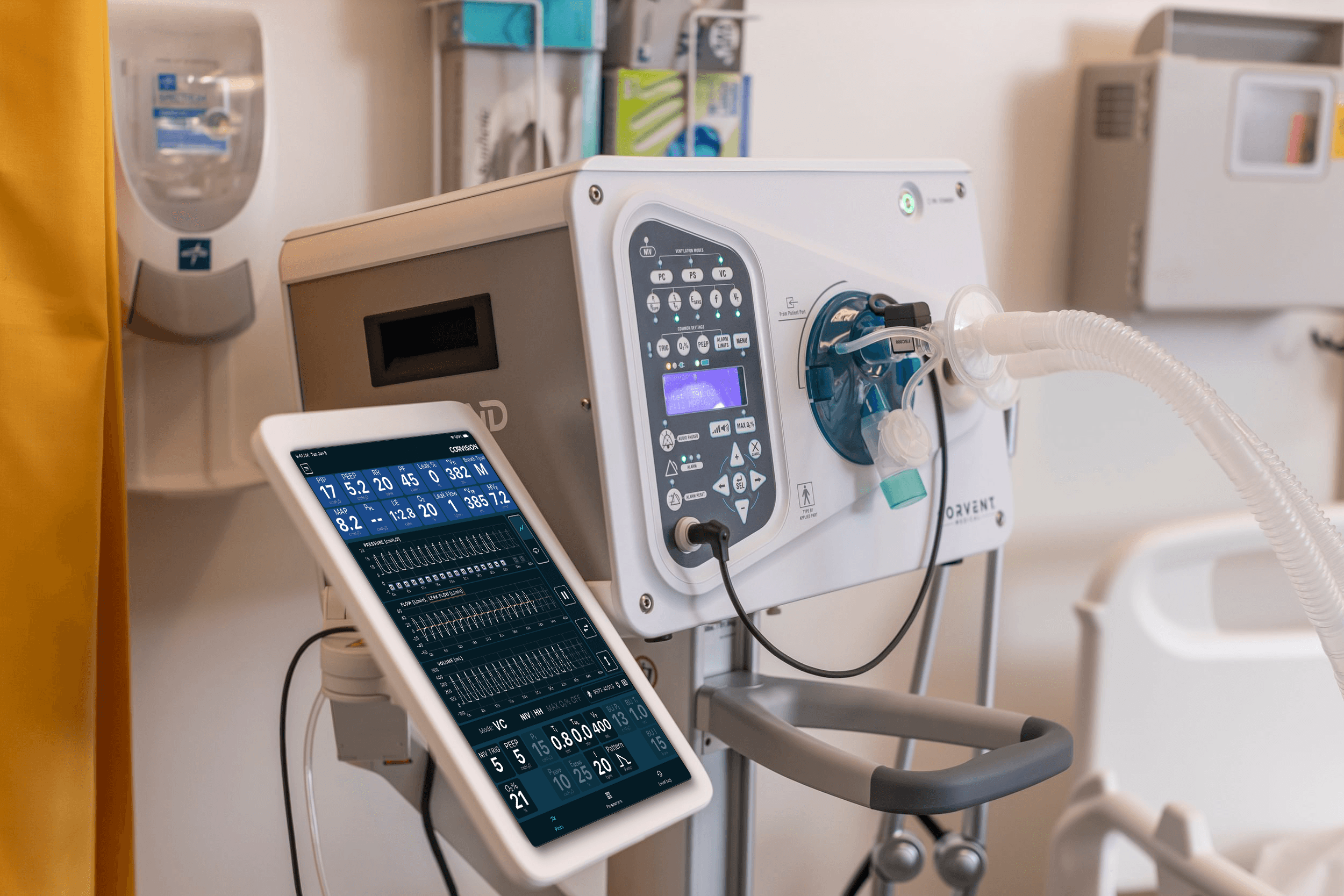 RESPOND and CorVision - remote patient monitoring