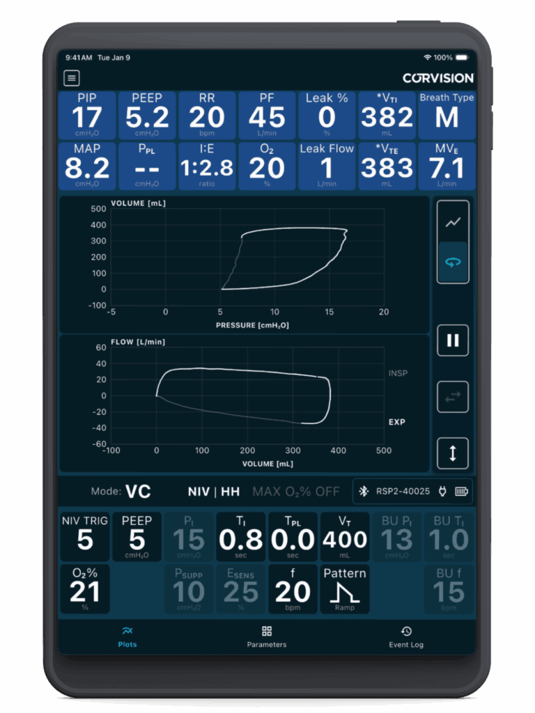 Loops - remote patient monitoring
