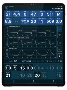 PC - remote patient monitoring
